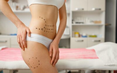 Mommy Makeover Scars: 5 Facts You Should Know Before You Decide