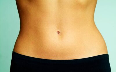 Mini Tummy Tuck Recovery Time Mini Tummy Tuck Recovery Time: A Realistic Timeline