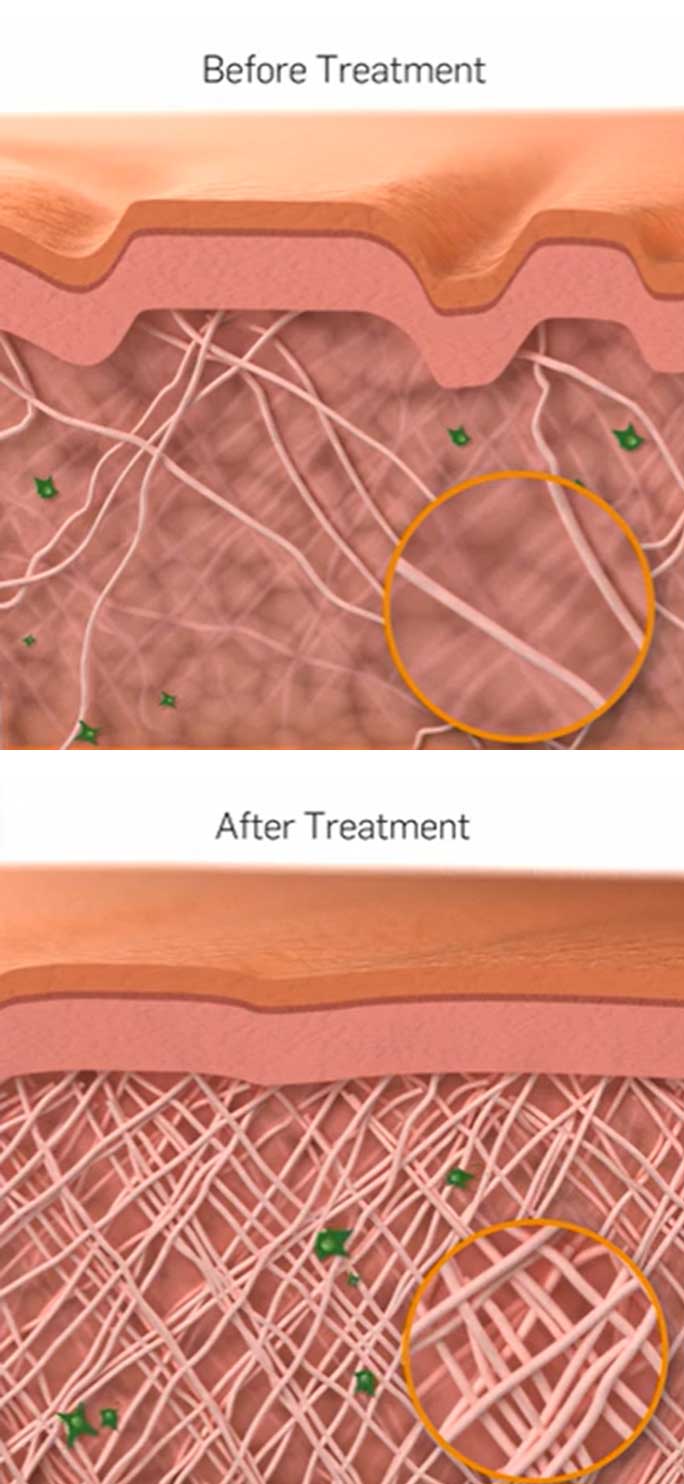 TempSure-Envi™