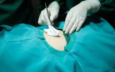 How to Choose a Qualified Plastic Surgeon in Toronto: 8 Critical Steps