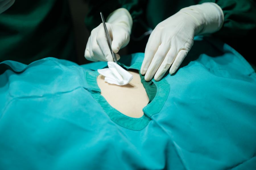 choosing qualifed surgeon in toronto choosing qualifed surgeon in toronto